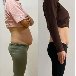 fat removal fat removal